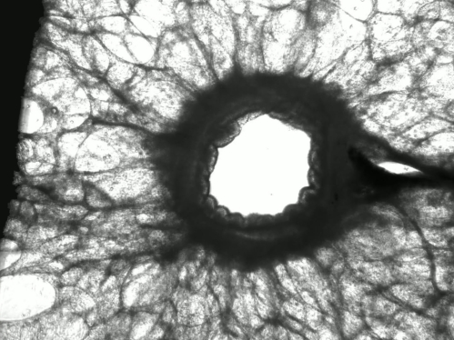 A black and white image of lung tissue 