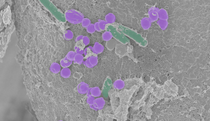 Microscope image of various strains of bacteria colored purple and green